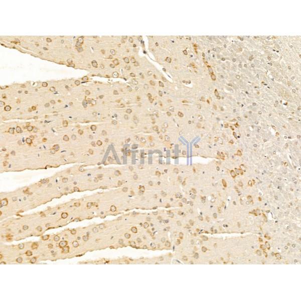 Nogo Receptor Antibody - DF13593 at 1/100 staining Rat brain tissue by IHC-P.