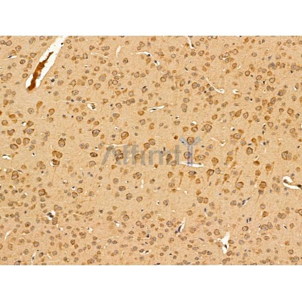 Nogo Receptor Antibody - DF13593 at 1/100 staining Mouse brain tissue by IHC-P.