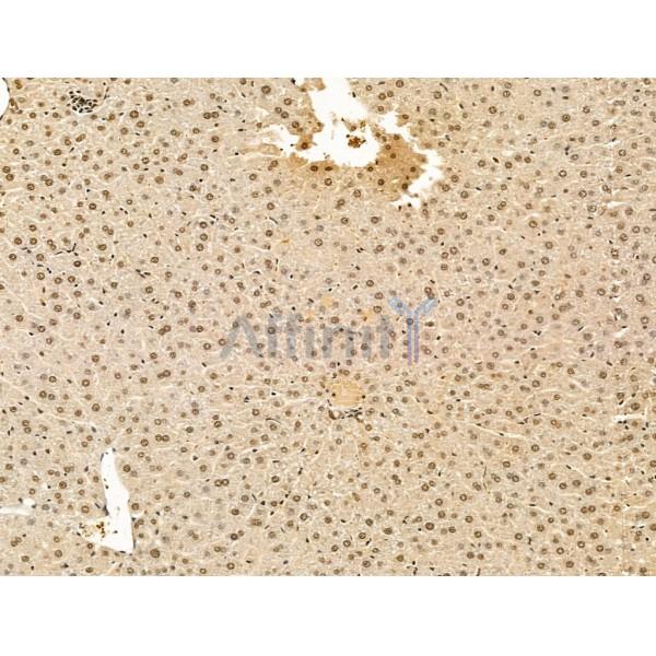 ADCY10 Antibody - DF13600 at 1/100 staining Mouse liver tissue by IHC-P.