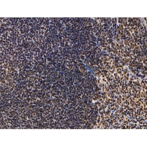 ADCY10 Antibody - DF13600 at 1/100 staining Mouse spleen tissue by IHC-P.