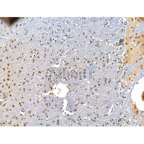 ADCY10 Antibody - DF13600 at 1/100 staining Rat brain tissue by IHC-P.