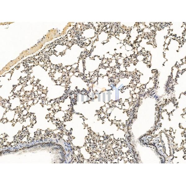 ADCY10 Antibody - DF13600 at 1/100 staining Mouse lung tissue by IHC-P.