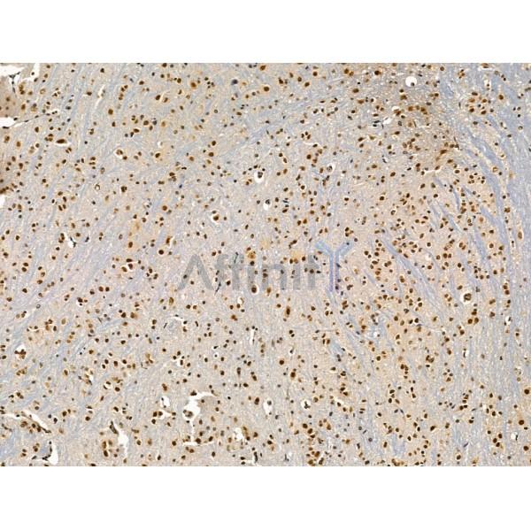 ADCY10 Antibody - DF13600 at 1/100 staining Mouse brain tissue by IHC-P.