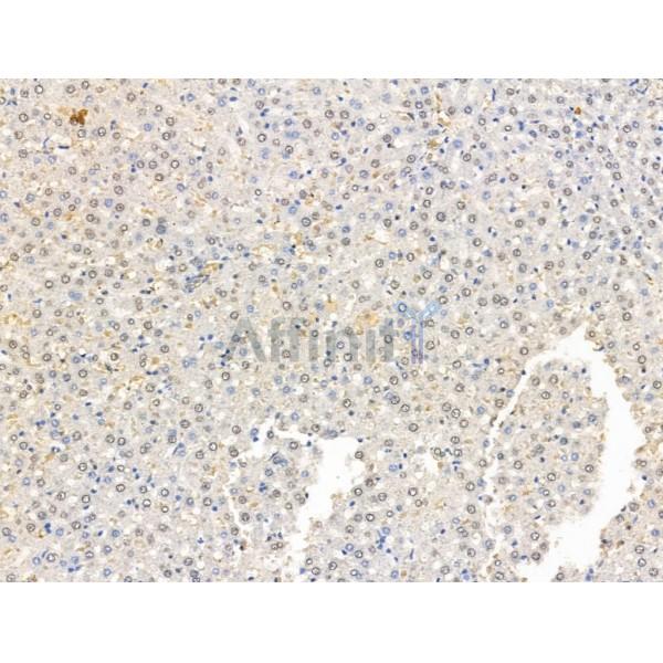 ADCY10 Antibody - DF13600 at 1/100 staining Rat liver tissue by IHC-P.