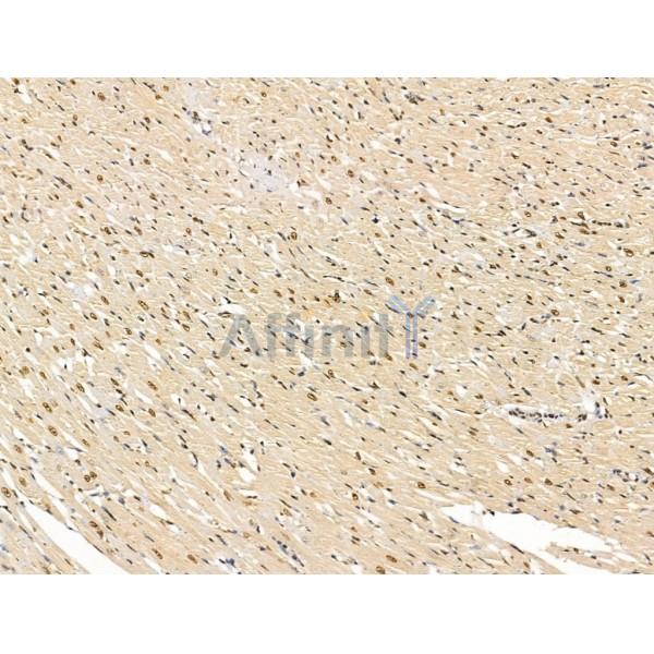 ADCY10 Antibody - DF13600 at 1/100 staining Rat heart tissue by IHC-P.