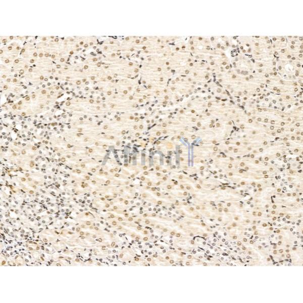 KLF2 Antibody - DF13602 at 1/100 staining Mouse kidney tissue by IHC-P.