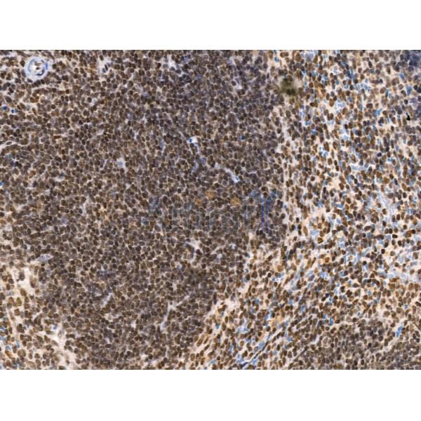 KLF2 Antibody - DF13602 at 1/100 staining Mouse spleen tissue by IHC-P.