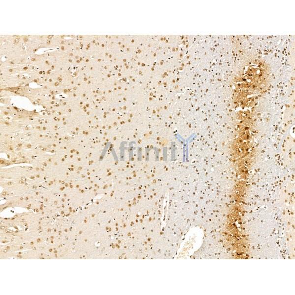 KLF2 Antibody - DF13602 at 1/100 staining Rat brain tissue by IHC-P.