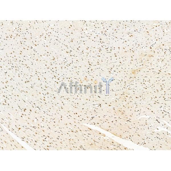 KLF2 Antibody - DF13602 at 1/100 staining Rat heart tissue by IHC-P.