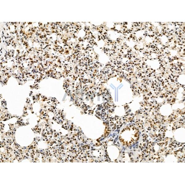 KLF2 Antibody - DF13602 at 1/100 staining Rat lung tissue by IHC-P.