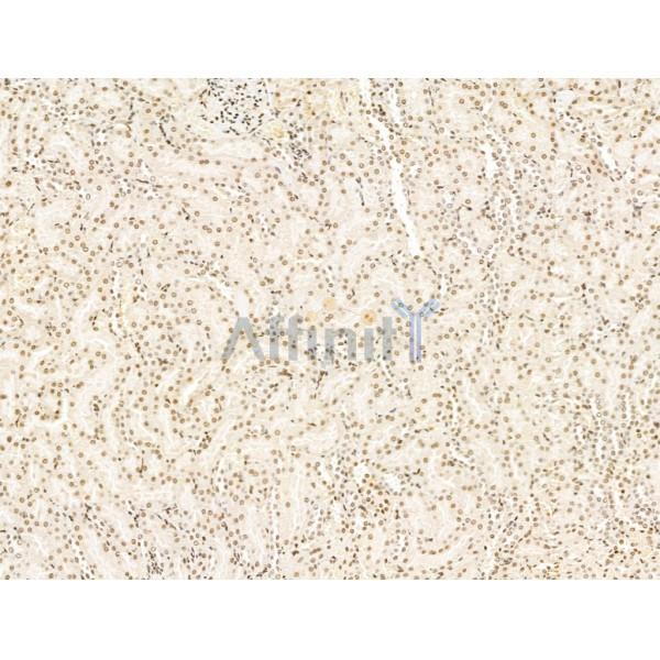 KLF2 Antibody - DF13602 at 1/100 staining Rat kidney tissue by IHC-P.