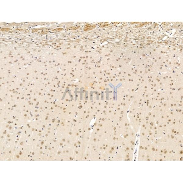 Nesprin 1 Antibody - DF13608 at 1/100 staining Mouse brain tissue by IHC-P.