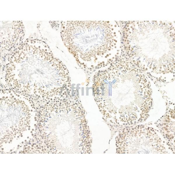 Nesprin 1 Antibody - DF13608 at 1/100 staining Rat testis tissue by IHC-P.
