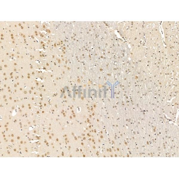 Nesprin 1 Antibody - DF13608 at 1/100 staining Rat brain tissue by IHC-P.