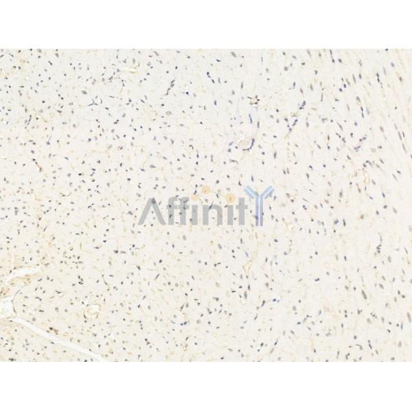 Amino-terminal enhancer of split Antibody - DF13613 at 1/100 staining Mouse heart tissue by IHC-P.