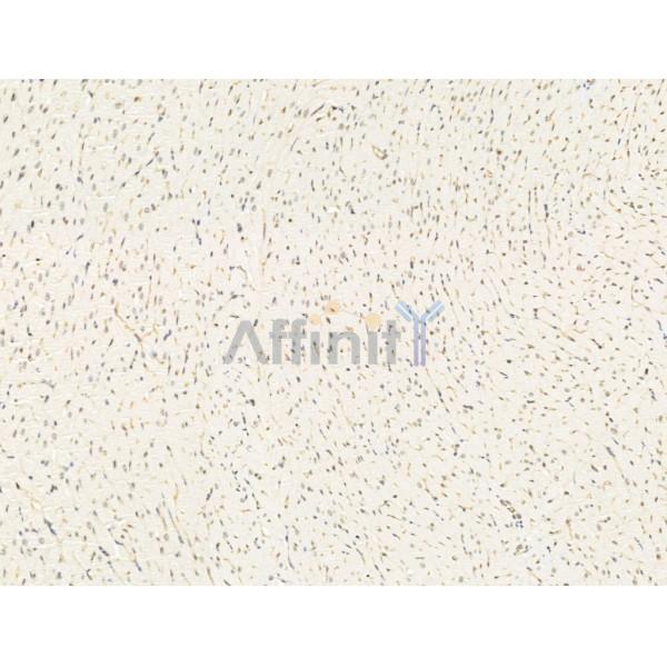 Amino-terminal enhancer of split Antibody - DF13613 at 1/100 staining Rat heart tissue by IHC-P.