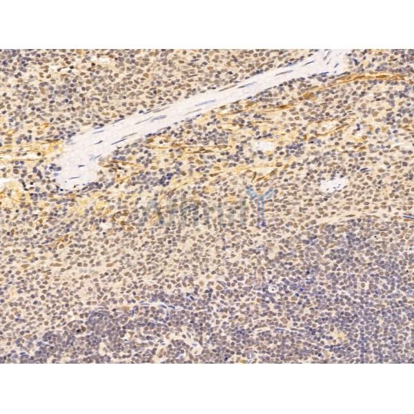 Amino-terminal enhancer of split Antibody - DF13613 at 1/100 staining Rat spleen tissue by IHC-P.