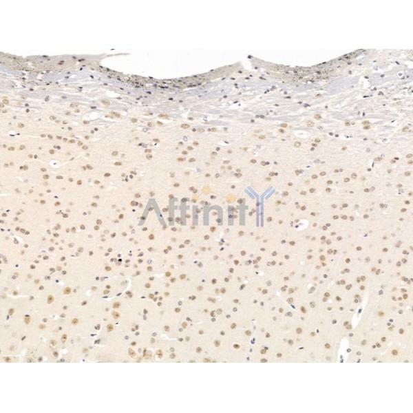 SSRP1 Antibody - DF13616 at 1/100 staining Mouse brain tissue by IHC-P.