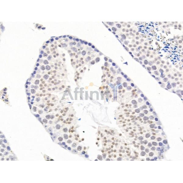 SSRP1 Antibody - DF13616 at 1/100 staining Mouse testis tissue by IHC-P.