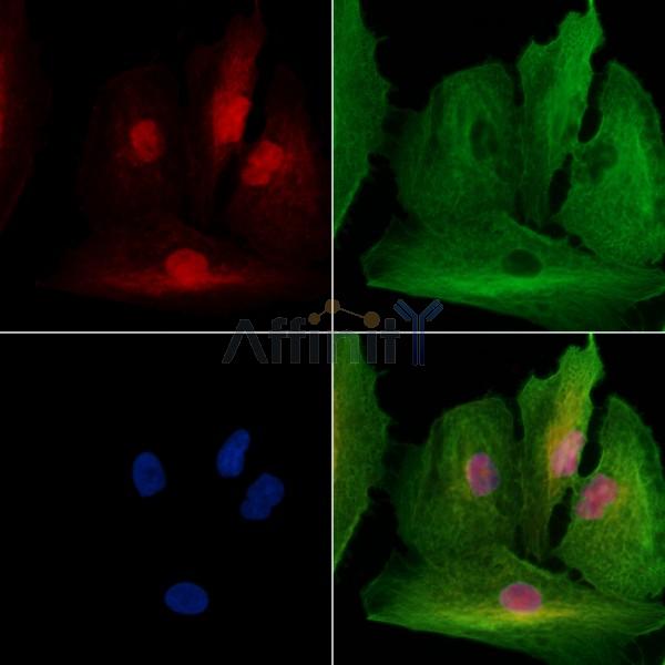 SSRP1 Antibody - DF13616 staining A549 cells by IF/ICC.