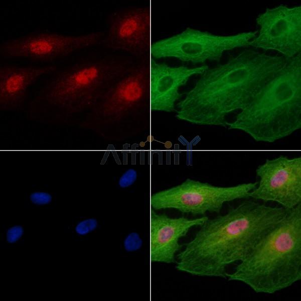FOXF2 Antibody - DF13619 staining A549 cells by IF/ICC.