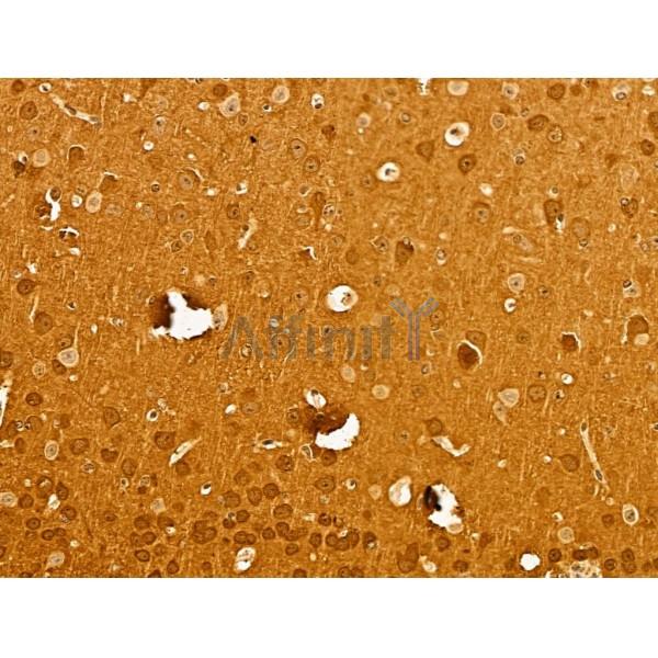Neurogranin Antibody - DF13620 at 1/100 staining Mouse brain tissue by IHC-P.