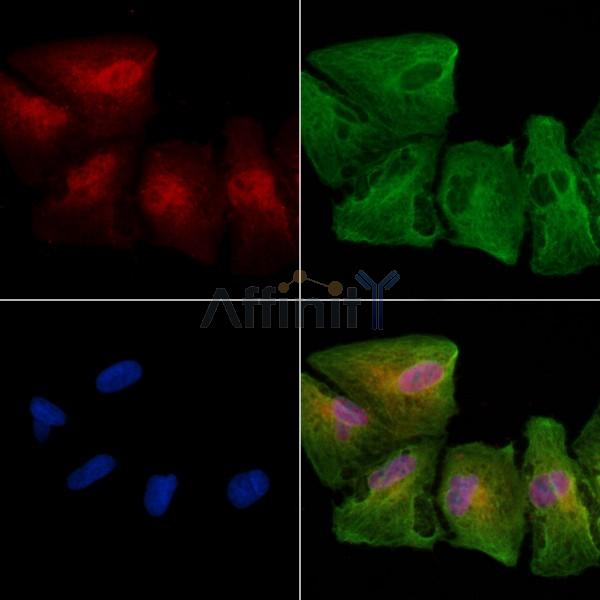 Neurogranin Antibody - DF13620 staining A549 cells by IF/ICC.