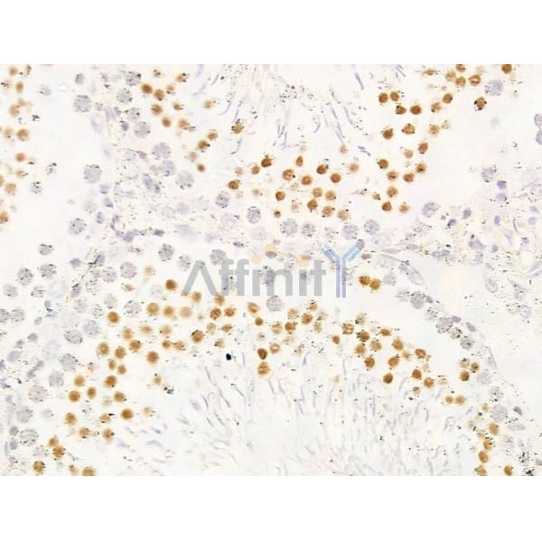 KDM5C / Jarid1C / SMCX Antibody - DF13631 at 1/100 staining Rat testis tissue by IHC-P.
