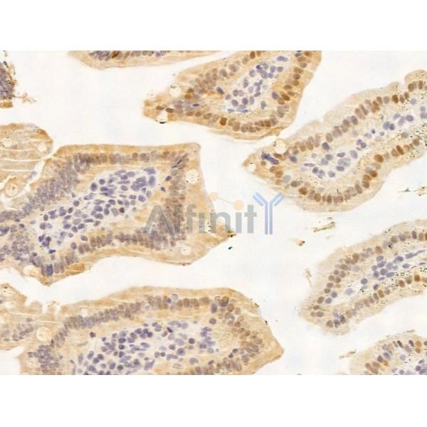 KDM5C / Jarid1C / SMCX Antibody - DF13631 at 1/100 staining Mouse colorectal tissue by IHC-P.