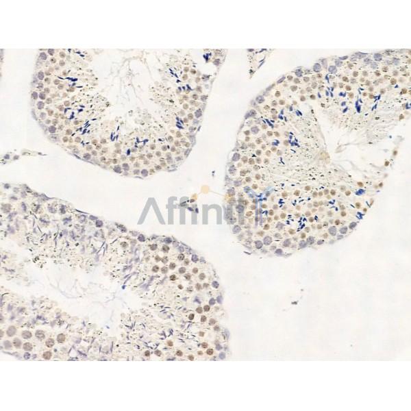 KDM5C / Jarid1C / SMCX Antibody - DF13631 at 1/100 staining Mouse testis tissue by IHC-P.