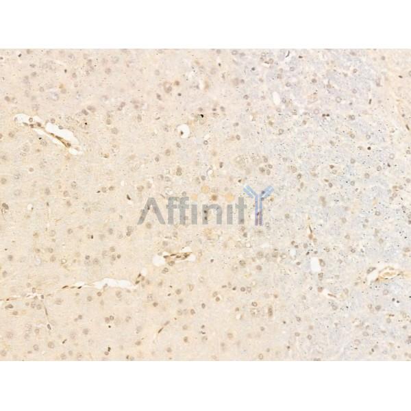 KDM5C / Jarid1C / SMCX Antibody - DF13631 at 1/100 staining Rat brain tissue by IHC-P.