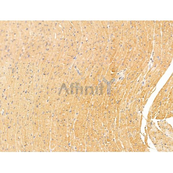 Connexin 40 / GJA5 Antibody - DF13633 at 1/100 staining Rat heart tissue by IHC-P.