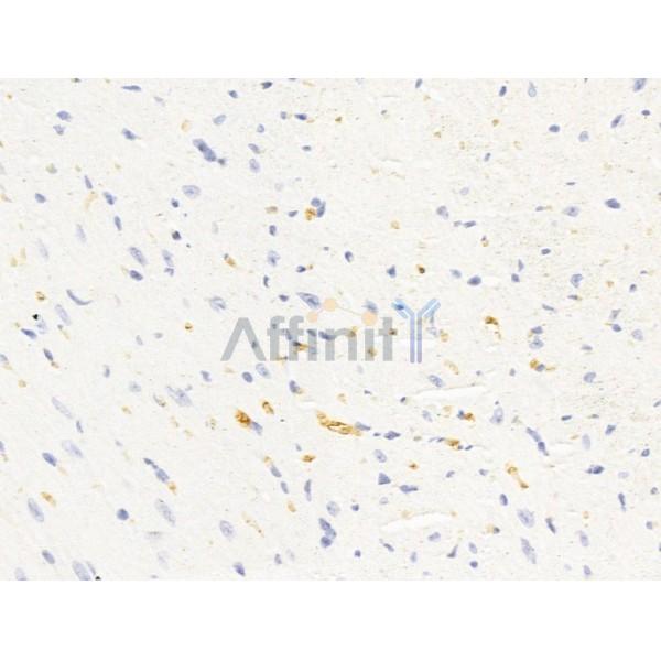 Hhip Antibody - DF13634 at 1/100 staining Mouse heart tissue by IHC-P.