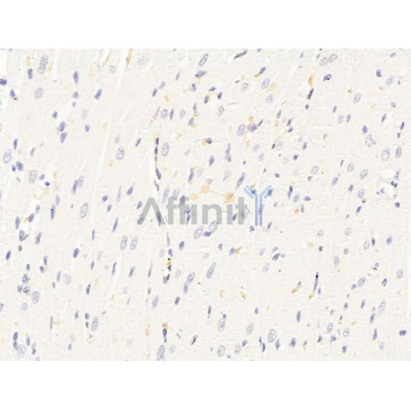 Hhip Antibody - DF13634 at 1/100 staining Rat heart tissue by IHC-P.