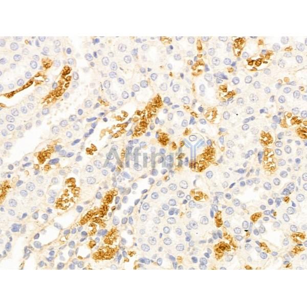 Hhip Antibody - DF13634 at 1/100 staining Rat kidney tissue by IHC-P.