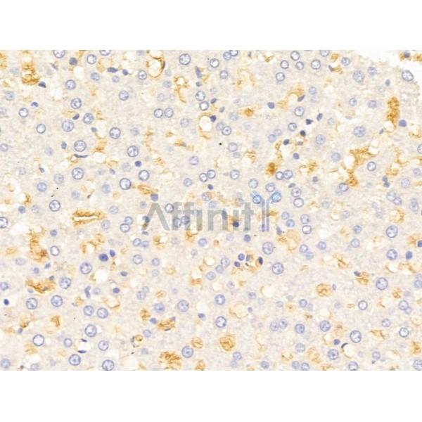 Hhip Antibody - DF13634 at 1/100 staining Rat liver tissue by IHC-P.