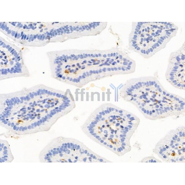 Hhip Antibody - DF13634 at 1/100 staining Mouse colorectal tissue by IHC-P.