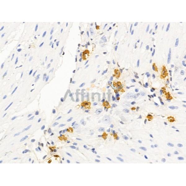 Hhip Antibody - DF13634 at 1/100 staining Mouse stomach tissue by IHC-P.