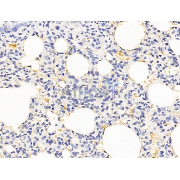 Hhip Antibody - DF13634 at 1/100 staining Rat lung tissue by IHC-P.