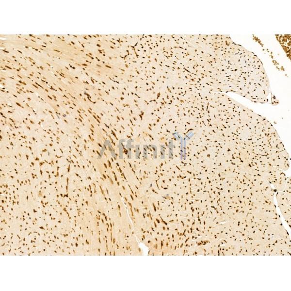 TIM 4 Antibody - DF13636 at 1/100 staining Mouse heart tissue by IHC-P.
