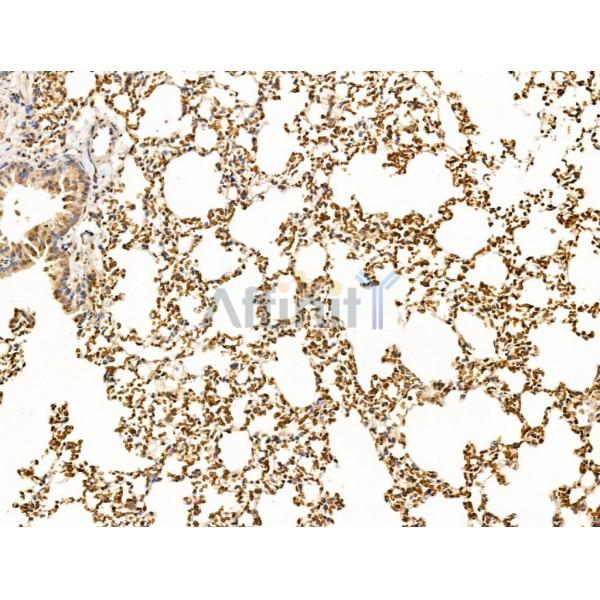 TIM 4 Antibody - DF13636 at 1/100 staining Mouse lung tissue by IHC-P.
