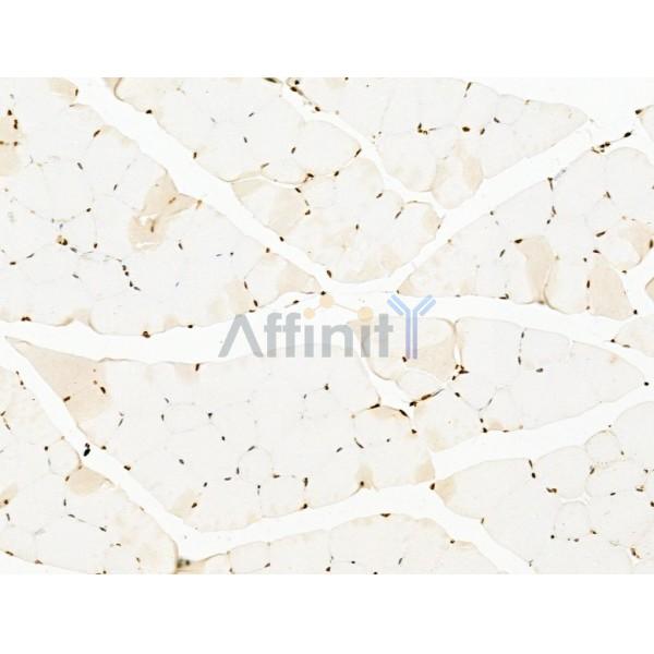 TIM 4 Antibody - DF13636 at 1/100 staining Mouse muscle tissue by IHC-P.
