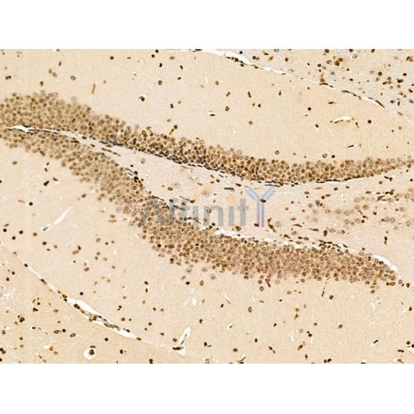 TIM 4 Antibody - DF13636 at 1/100 staining Mouse brain tissue by IHC-P.