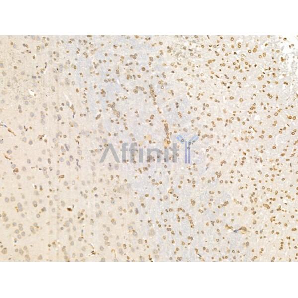 TIM 4 Antibody - DF13636 at 1/100 staining Rat brain tissue by IHC-P.