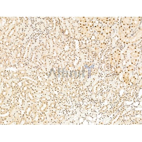L3MBTL1 Antibody - DF13640 at 1/100 staining Rat kidney tissue by IHC-P.