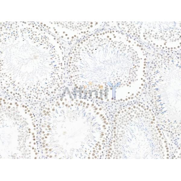 L3MBTL1 Antibody - DF13640 at 1/100 staining Rat testis tissue by IHC-P.