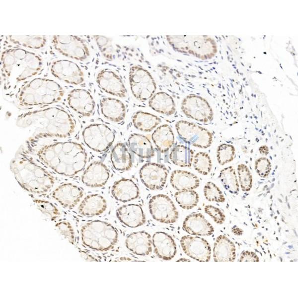 L3MBTL1 Antibody - DF13640 at 1/100 staining Rat colorectal tissue by IHC-P.