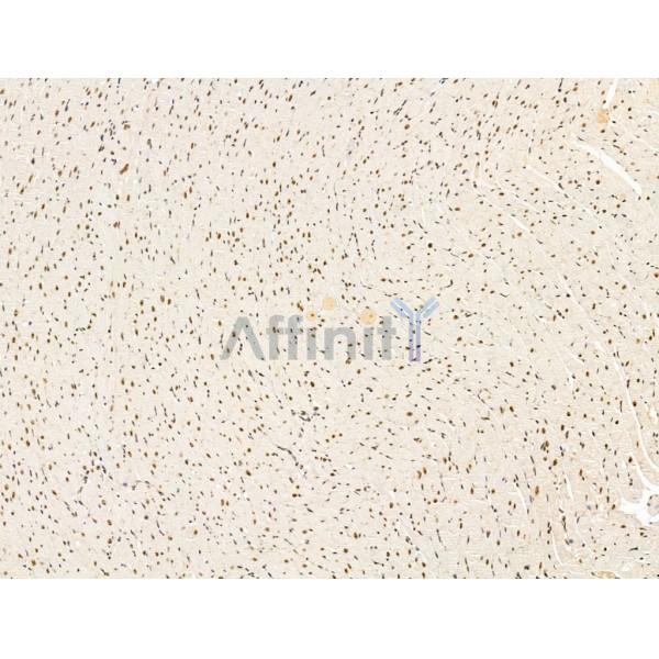 L3MBTL1 Antibody - DF13640 at 1/100 staining Rat heart tissue by IHC-P.