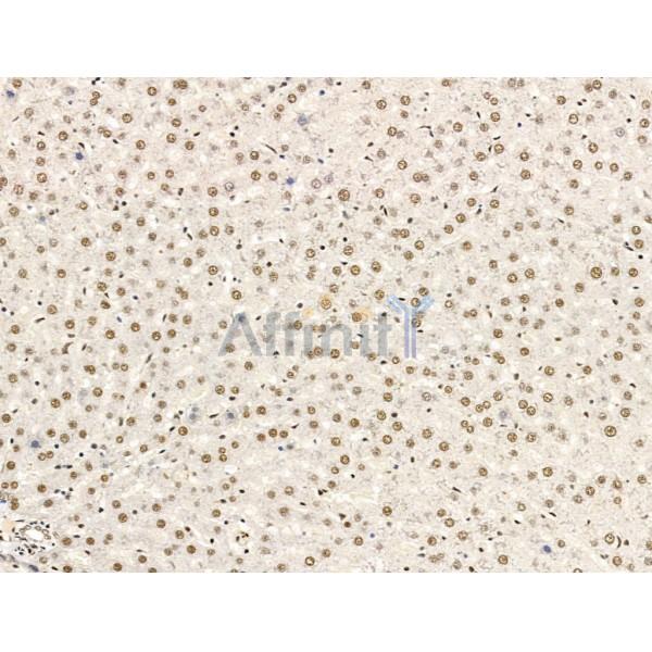 L3MBTL1 Antibody - DF13640 at 1/100 staining Rat liver tissue by IHC-P.