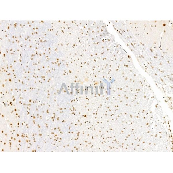 L3MBTL1 Antibody - DF13640 at 1/100 staining Rat brain tissue by IHC-P.